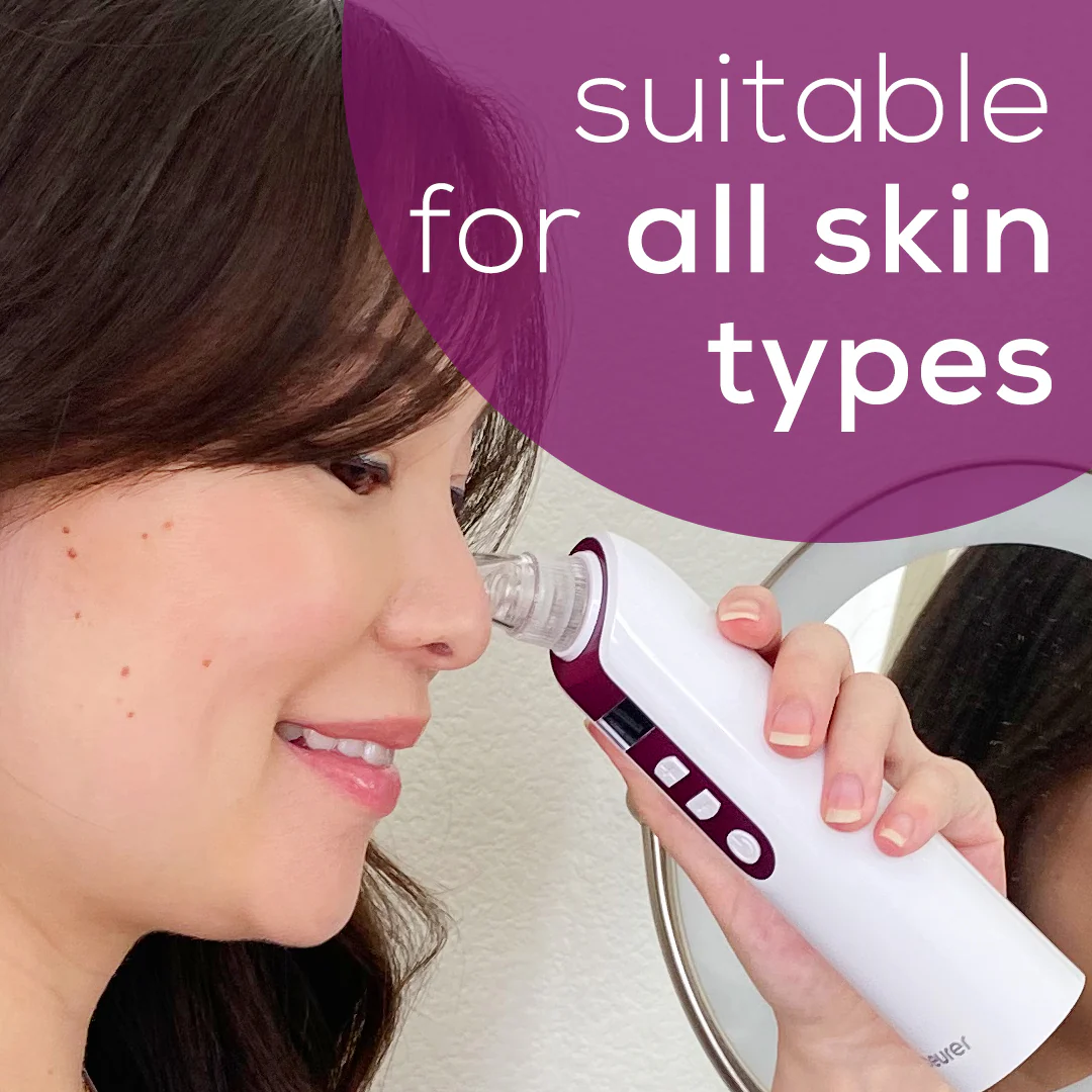 Rechargeable Deep Pore Cleanser | Vacuum Blackhead Remover & Skin Care Tool - Image 13